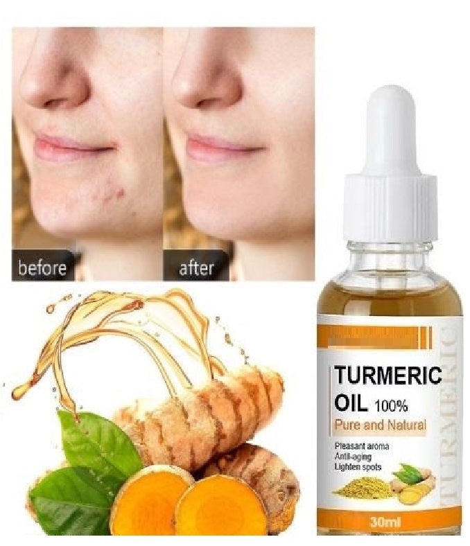 Turmeric Oil 30 ML (Pack of 1)