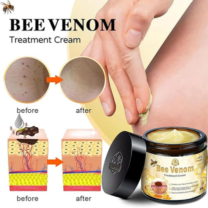 Bee Venom Skin Treatment Cream,Repair Maximum Strength for All Skin Types (2PCS)