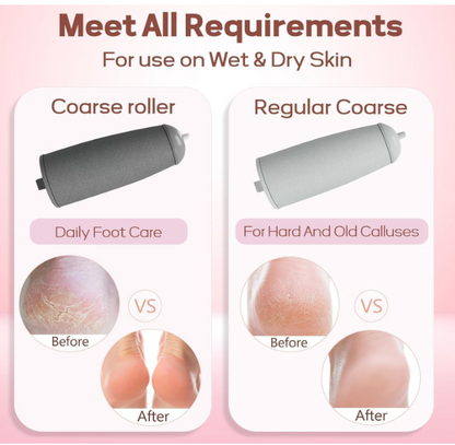 callus remover for feet dead skin remover pedicure tools Callus Remover Hard and Dead Skin Remover Electric Foot Callus Remover Rechargeable Pedicure Tool.